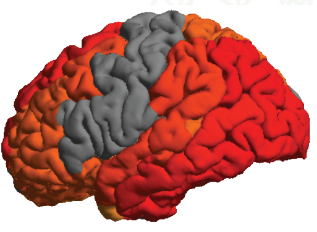 IGC_brain.png